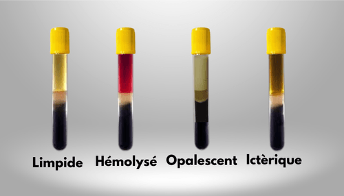 Tout savoir sur : Aspect du sérum - Biosaône, laboratoire d'analyses